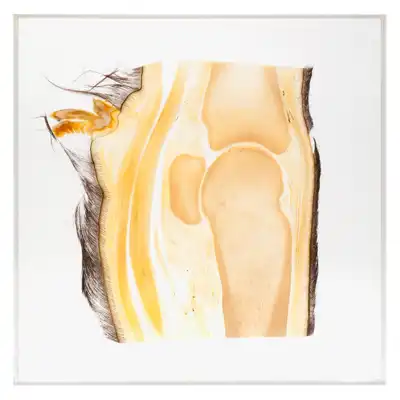 Scheibenplastinate Fesselgelenk_1