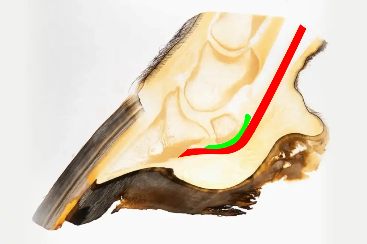 Représentation du tendon fléchisseur